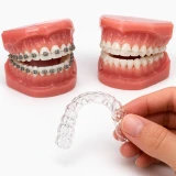 Ortodontia e Invisalign
